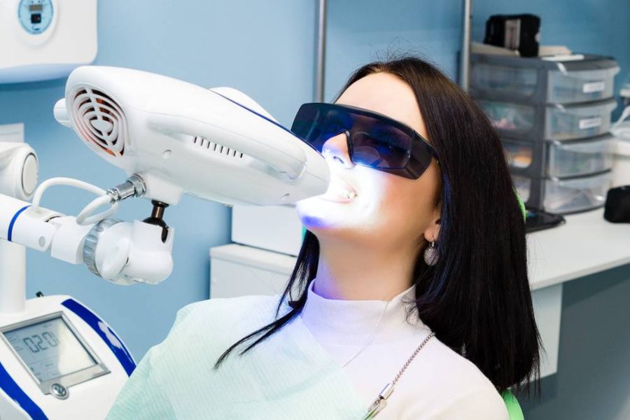 How To Maintain Results After Laser Teeth Whitening